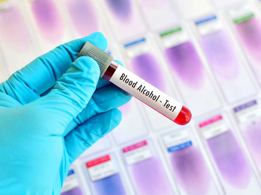 在西咸新区哪个医院能做DNA亲子鉴定,西咸新区医院办理血缘检测的流程